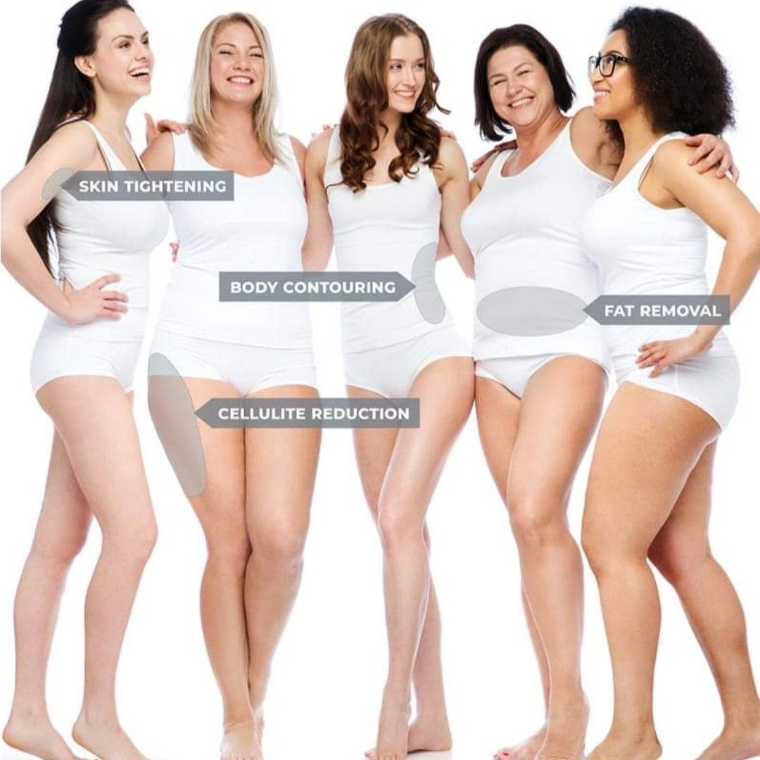 lipo-cavitation treatment result